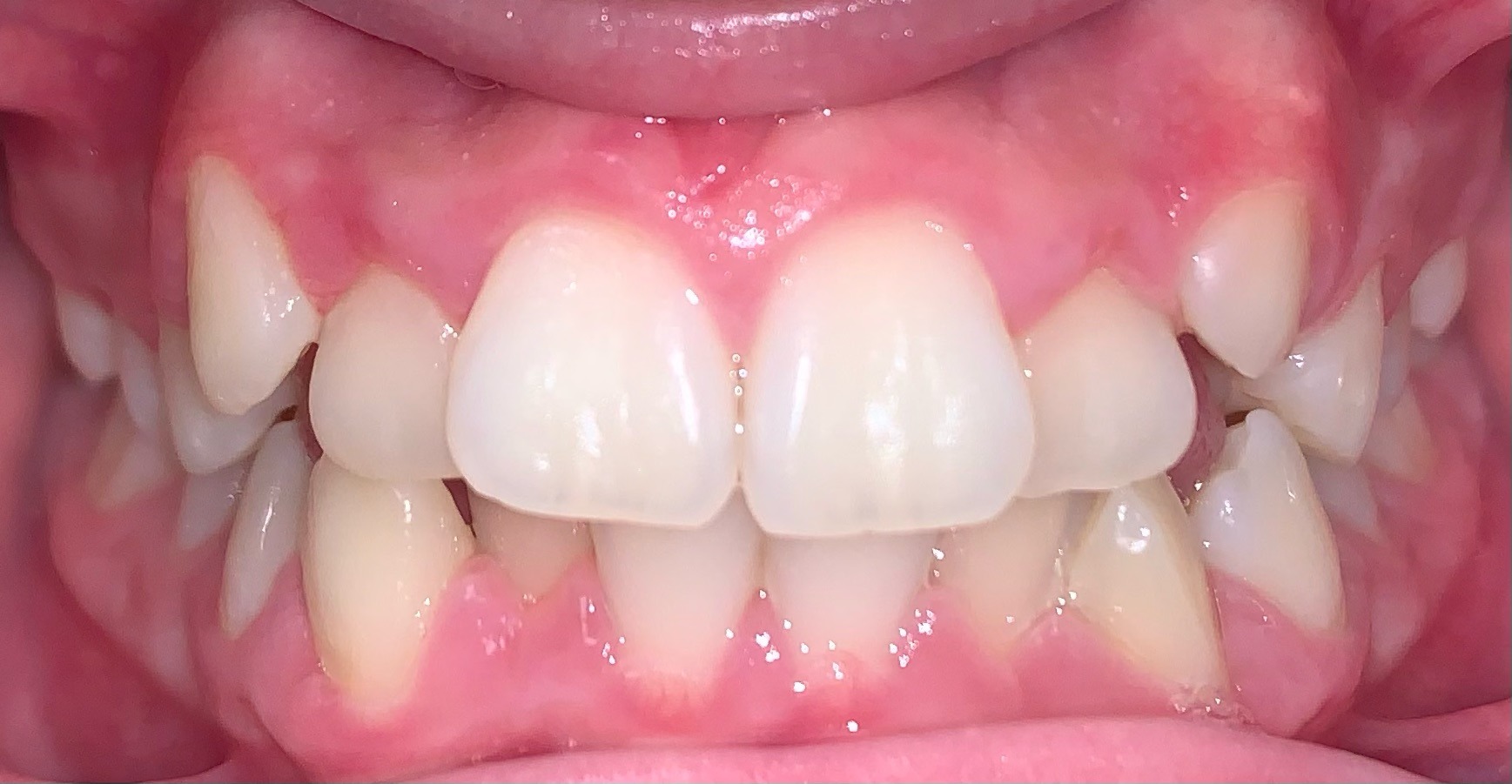 before Image