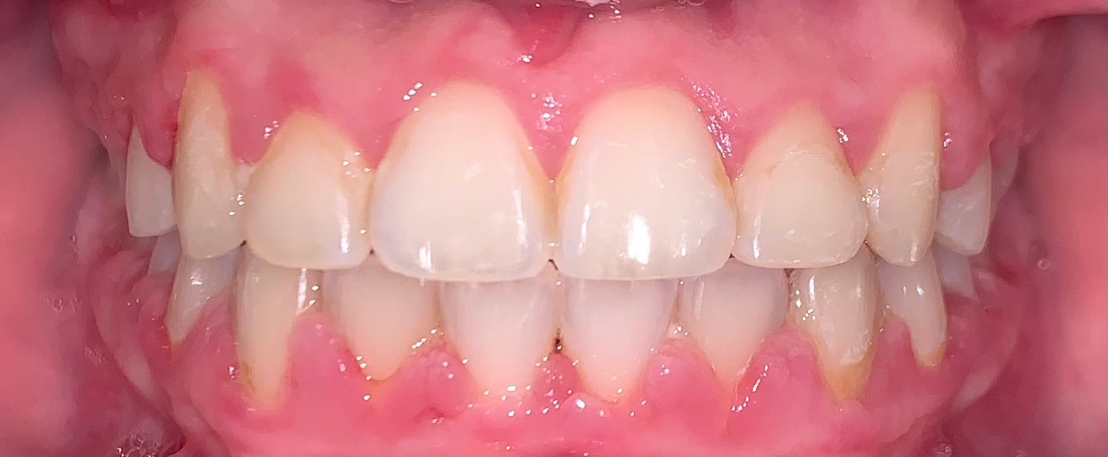 after Image