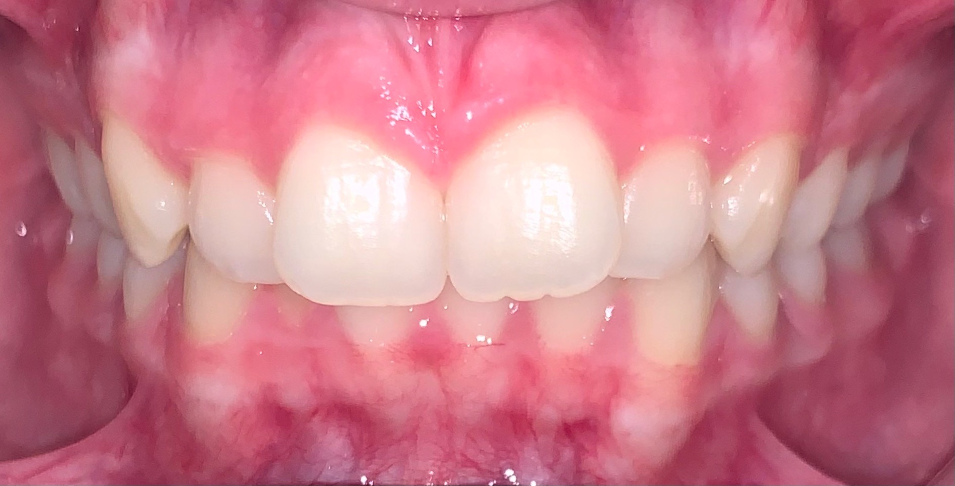 before Image