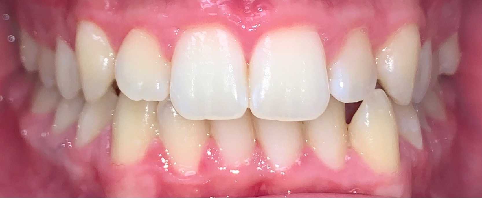 before Image
