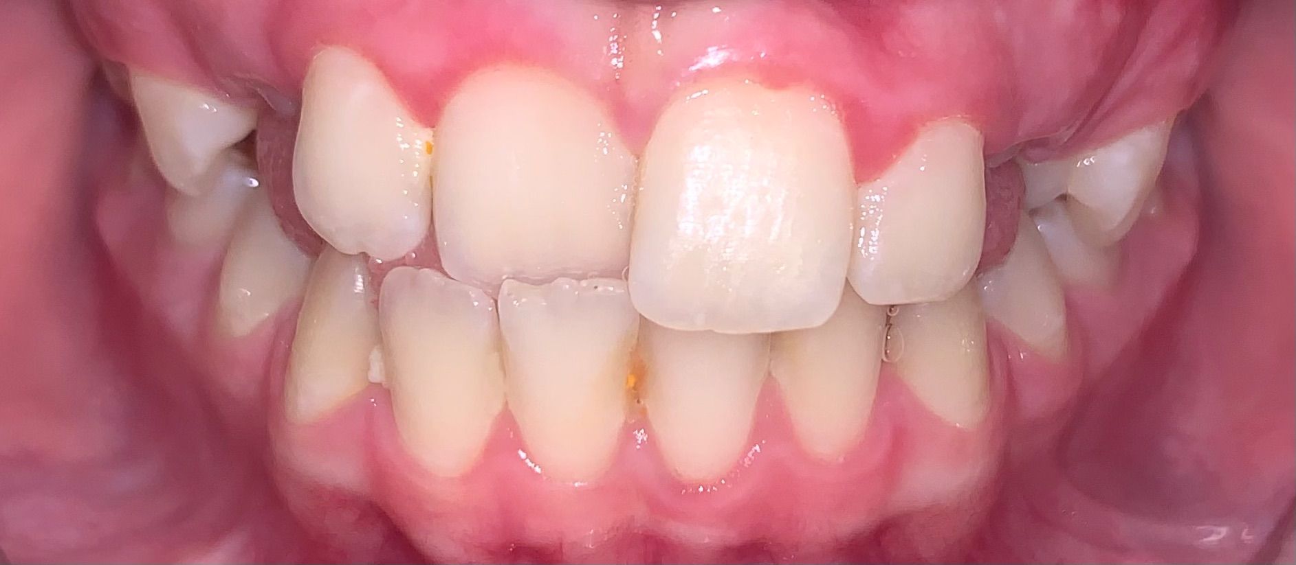 before Image