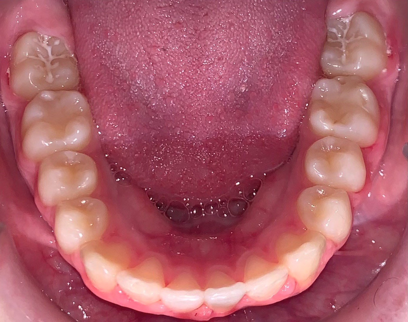 after Image