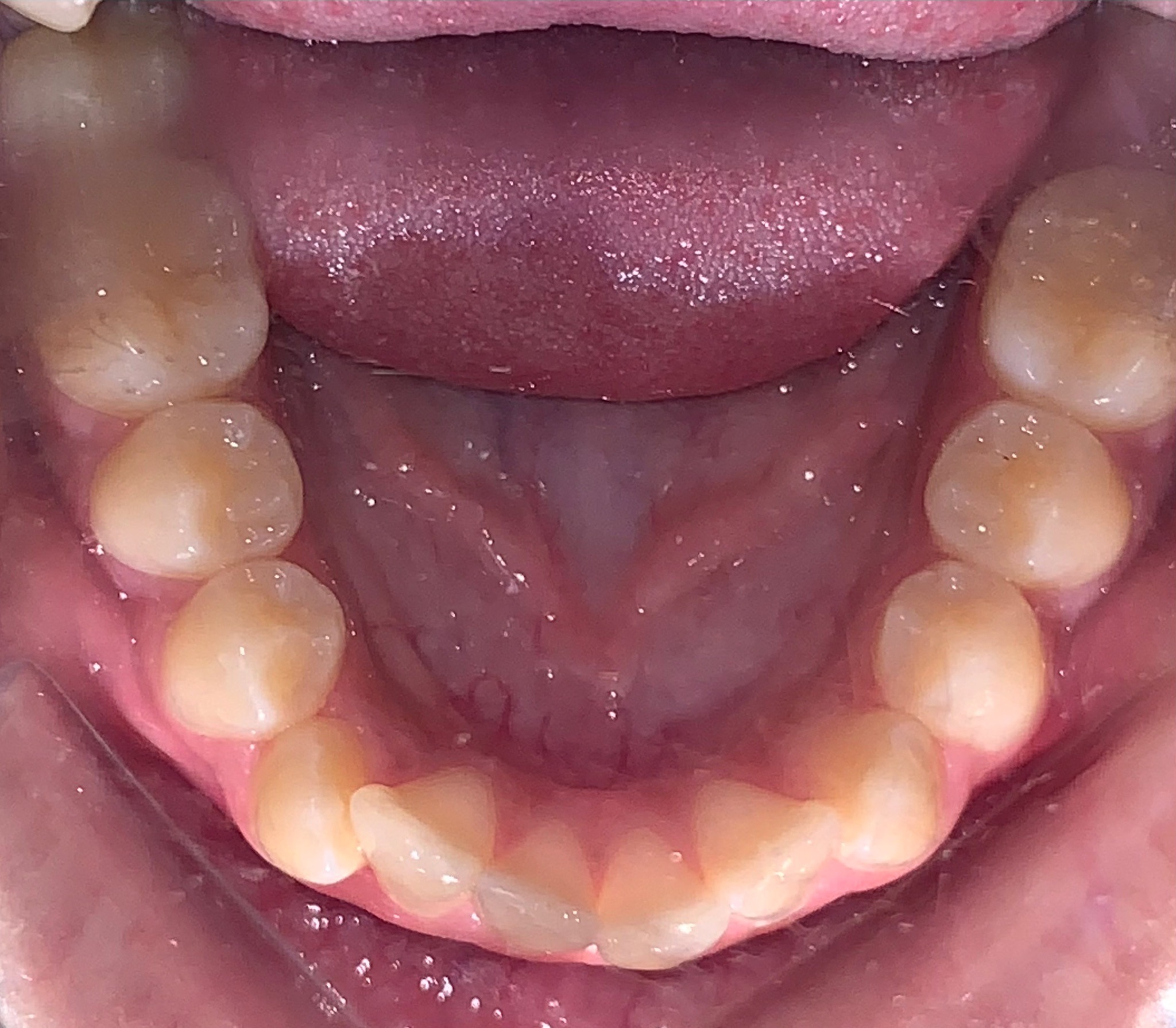 before Image