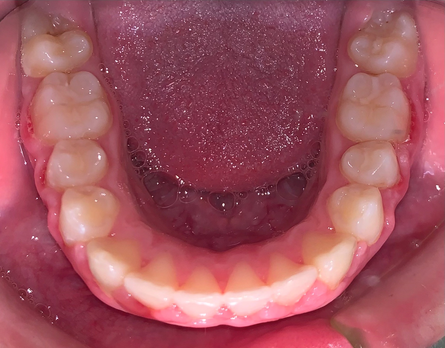 after Image