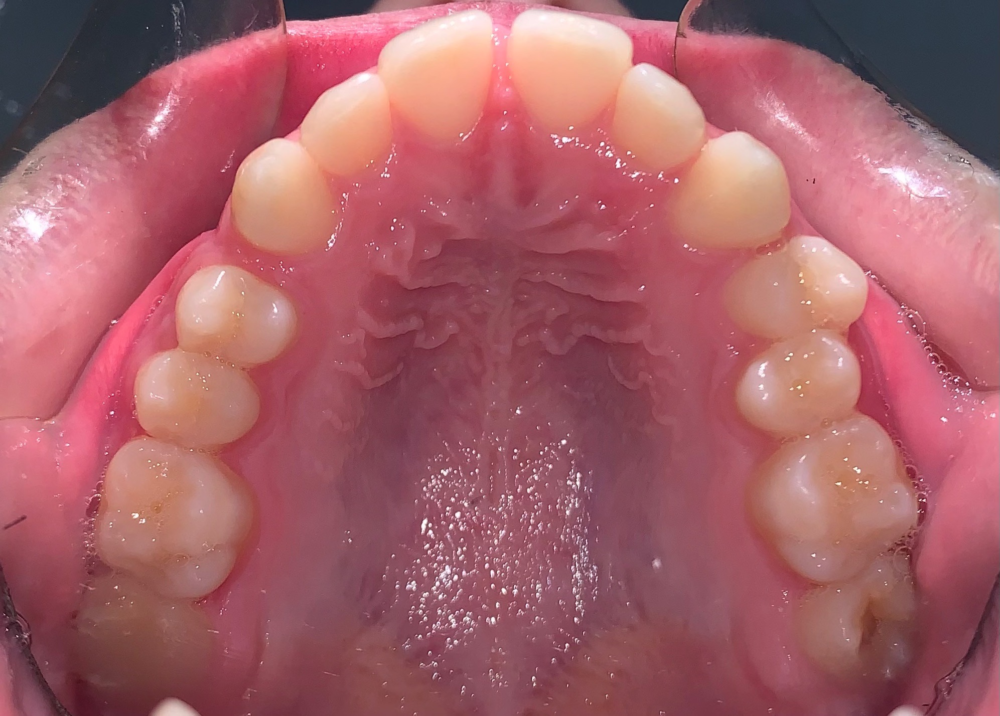 before Image