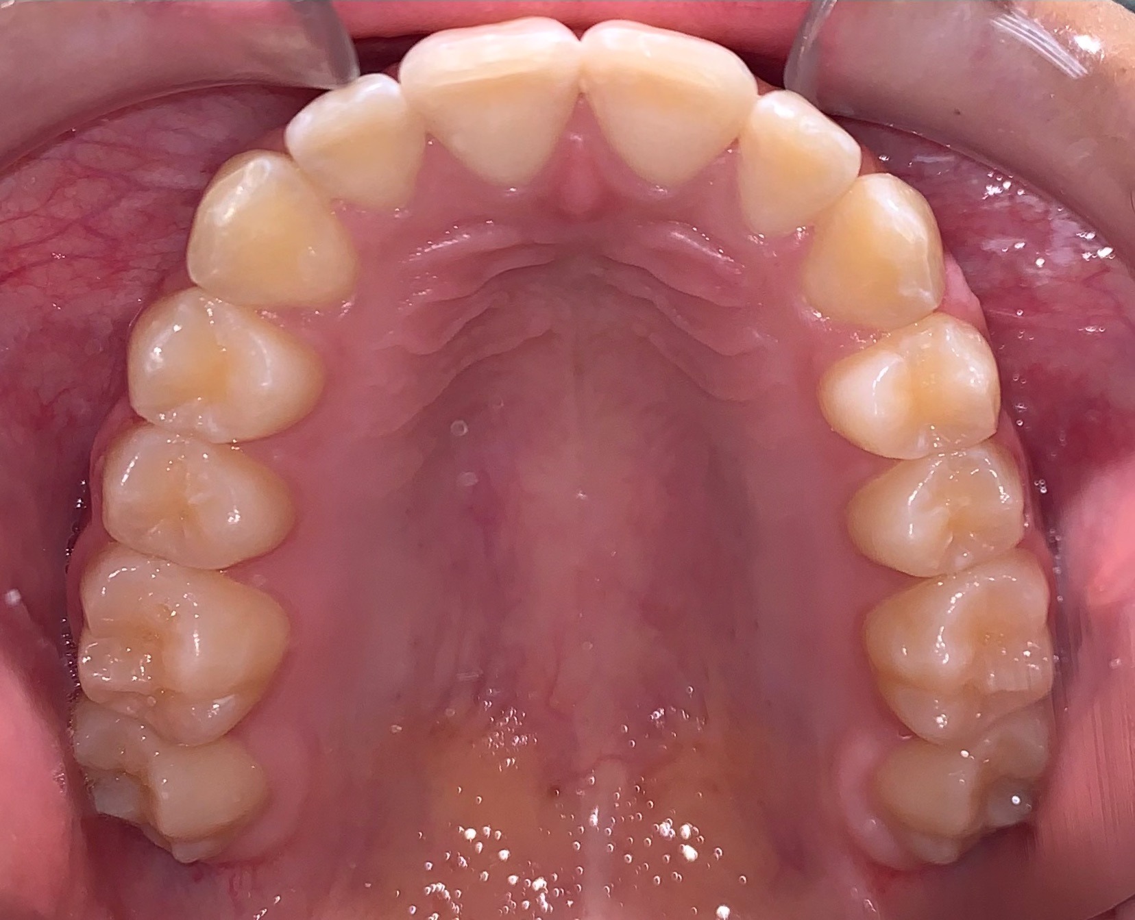 after Image