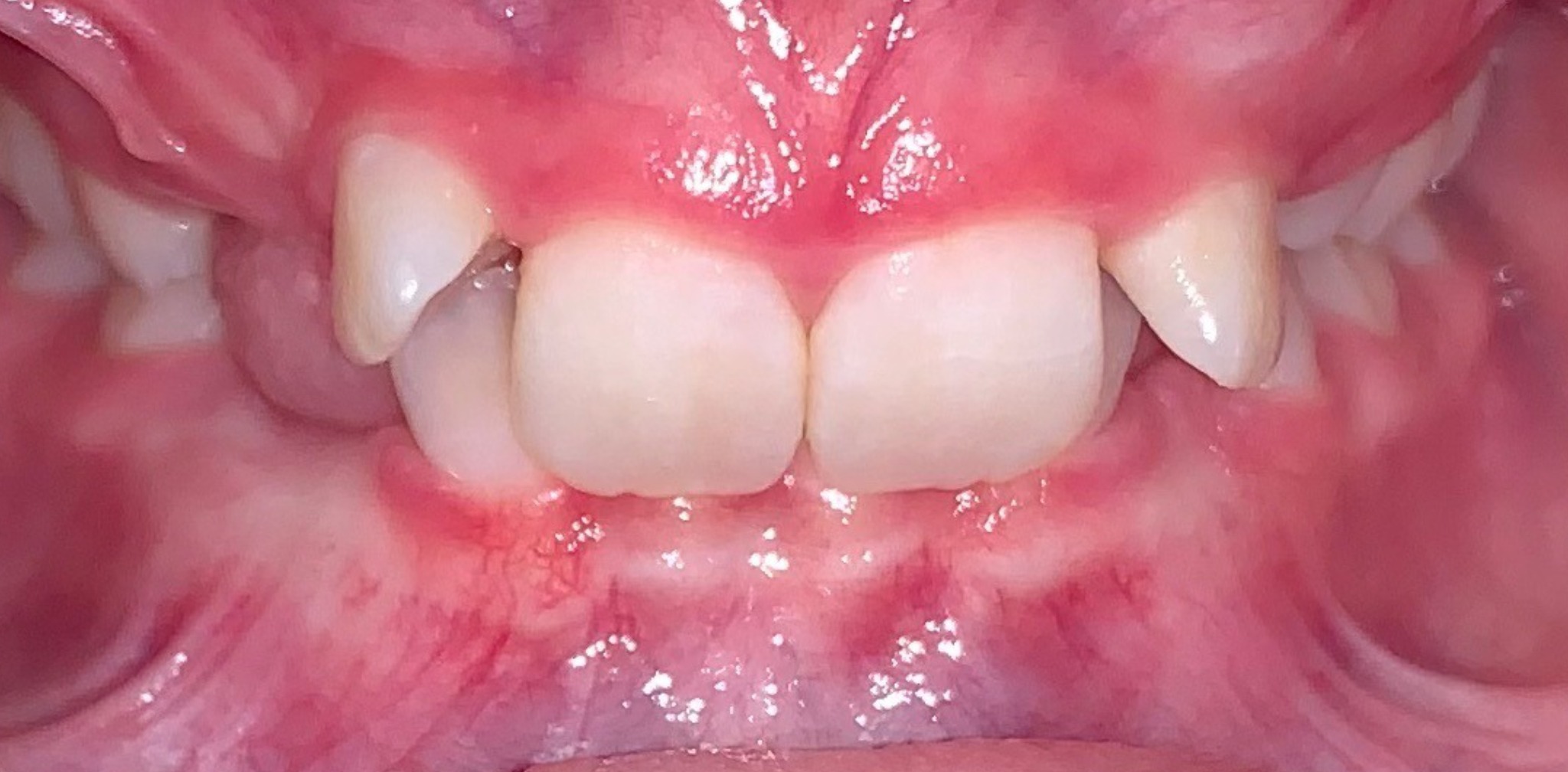 before Image