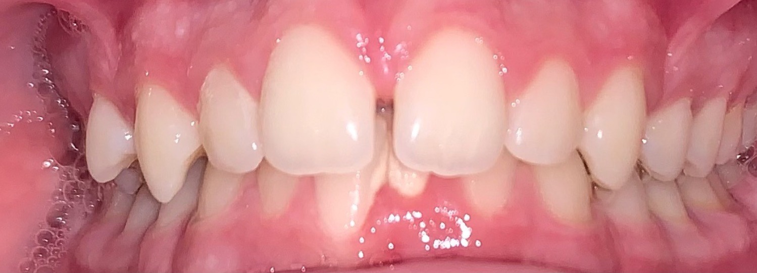 before Image