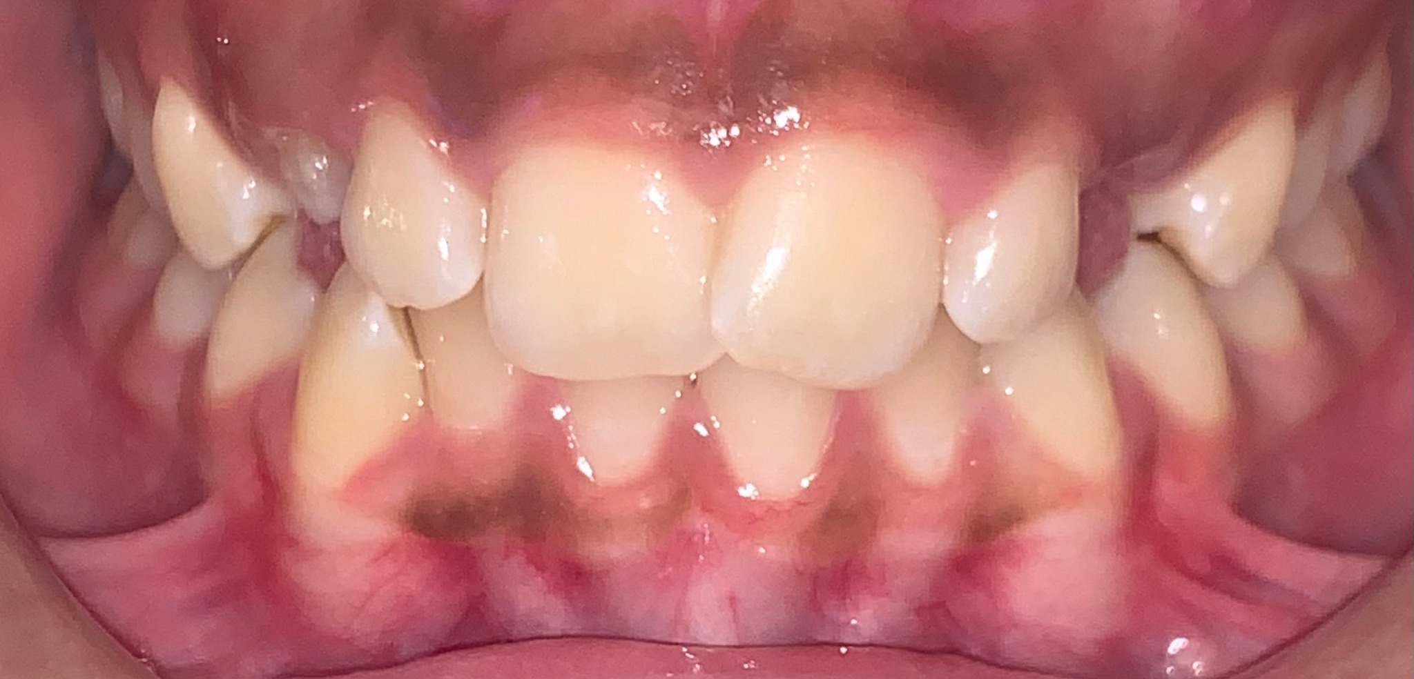 before Image
