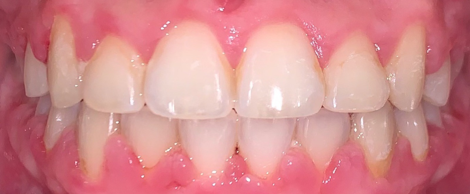 after Image
