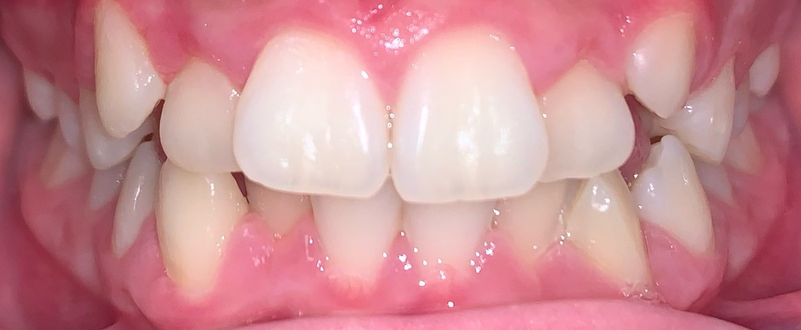 before Image