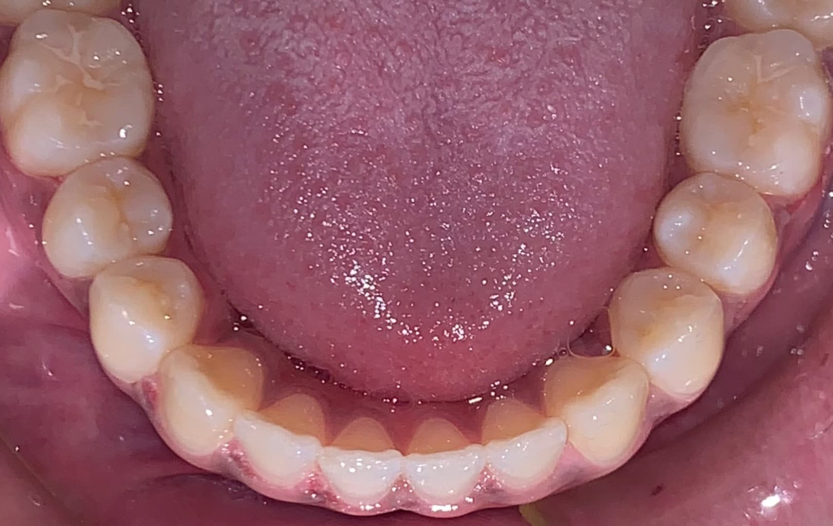 after Image