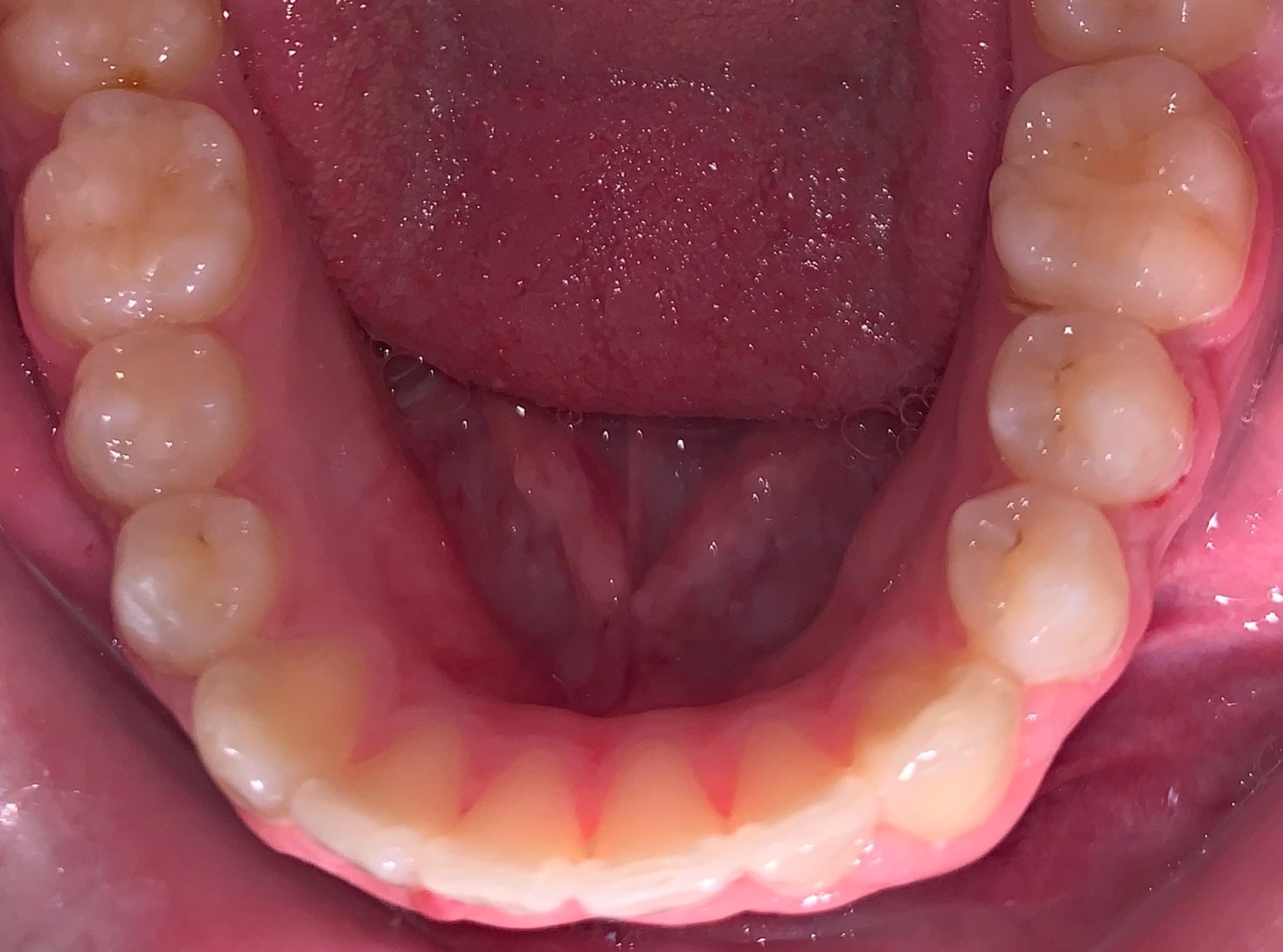after Image