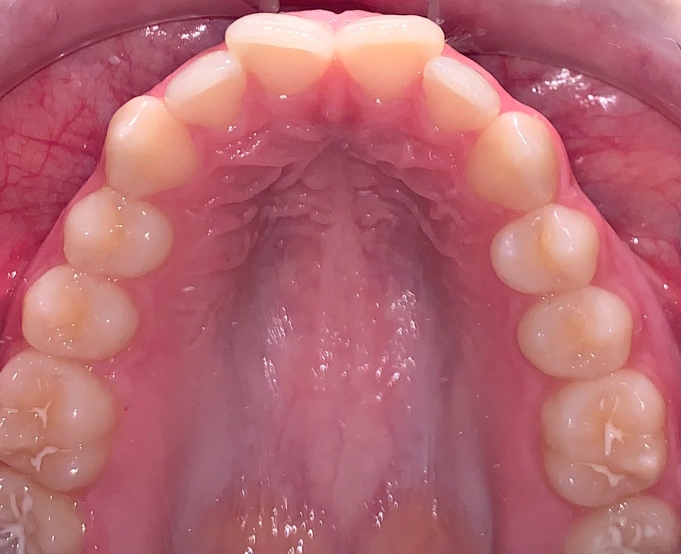 before Image